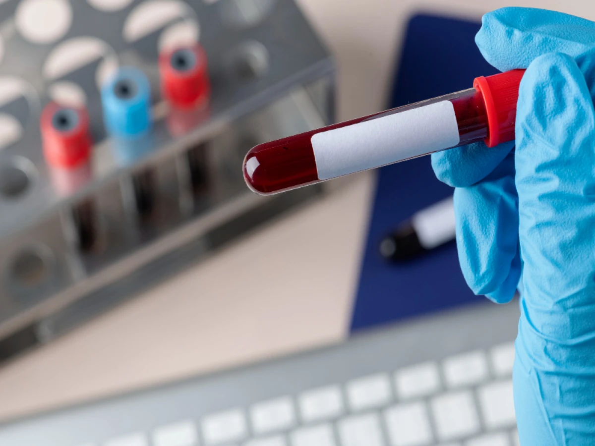 pós-graduação ead em hematologia clínica e hemoterapia 720 horas 