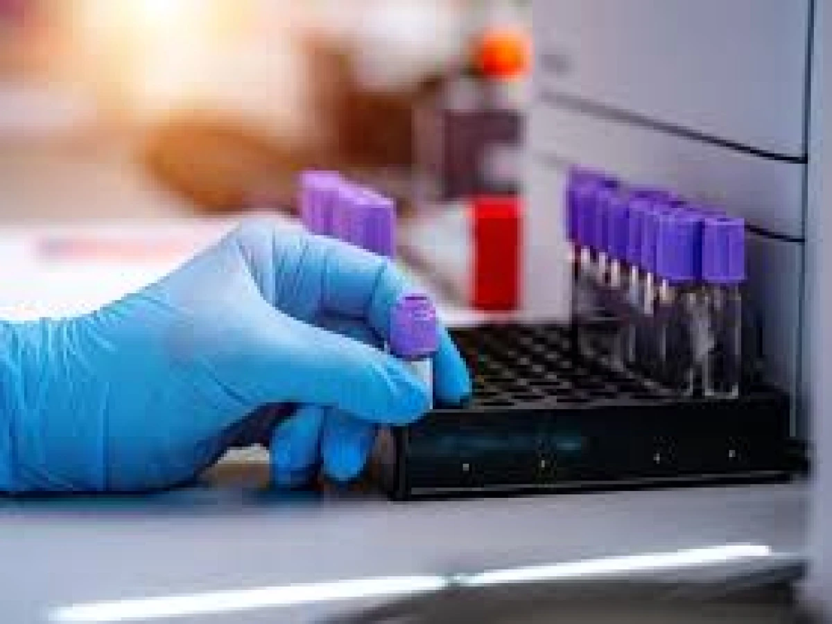 curso online de hematologia e instrumentação laboral 420 horas 